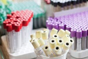 Kuvituskuva, Näytteenottopulloja laboratoriossa